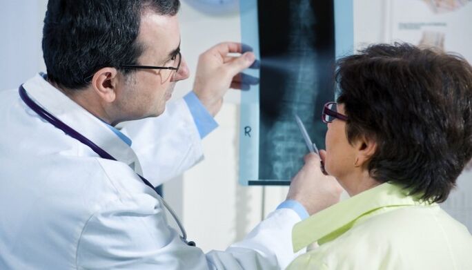 x-ray sa dugokan nga adunay osteochondrosis