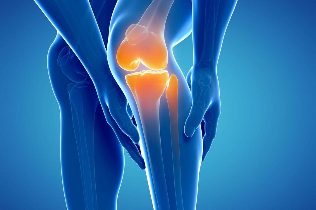 Unsa ang Arthrosis
