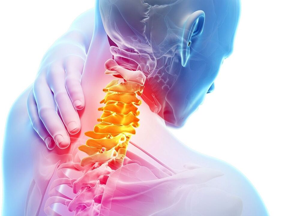 lokalisasyon sa osteochondrosis