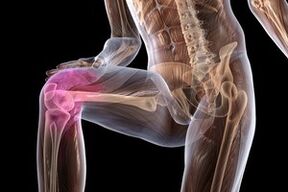 joint pain tungod sa tuhod arthrosis